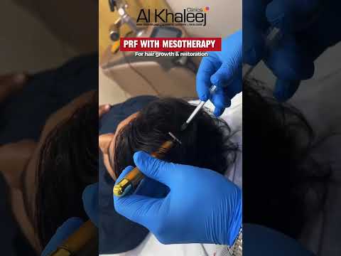 PRF Mesotherapy before and after results at Alkhaleej Clinics Karachi