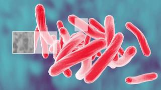 Screening for Latent Tuberculosis Infection (LTBI)