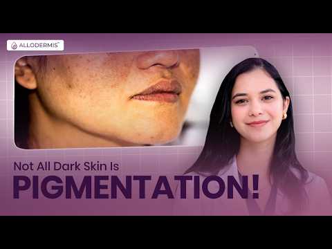 Allodermis featured video