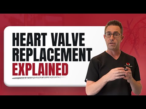 Heart Valve Replacement Explained | From Open-Heart Surgery to TAVR