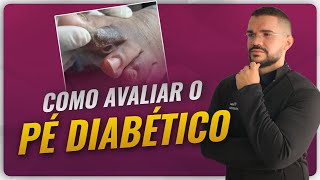 COMO REALIZAR EXAME FISICO NO PÉ DIABETICO NA PRATICA
