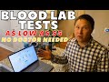 Unveil Your Blood Test Results Online: A Convenient Journey to Health Insights