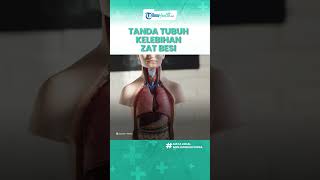Risiko Bila Tubuh Kelebihan Zat Besi Bisa Picu Penyakit Serius, Kenali Tandanya sejak Awal