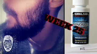 Minoxidil Beard | Week 25 | The Experiment | #Facialfuzzfridays