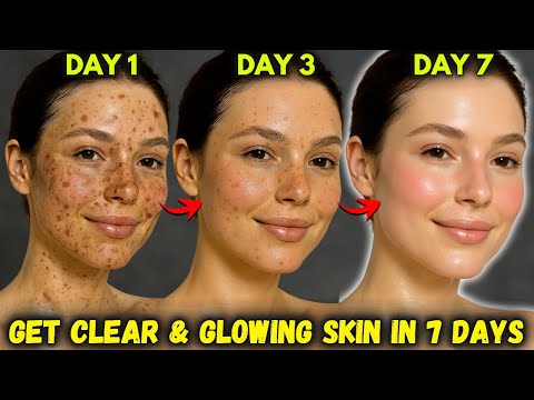 7-Tage-Haut-Glow-Up mit DIY-Serum + Creme, die Wunder wirkt ✨ Keine dunklen Flecken, keine Pigmen...