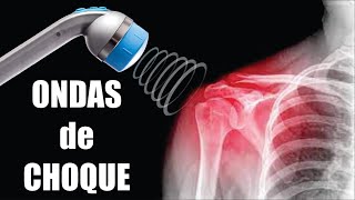 ONDAS DE CHOQUE: Qué Son 💪🏼 Cómo Funcionan 🦵🏼 Para Qué Sirven ☝🏼 Tipos ⭐ Dr. EDSON SERRANO Perú