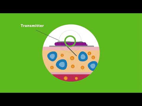 LBL021387 Rev001 - An Introduction to Continuous Glucose Monitoring