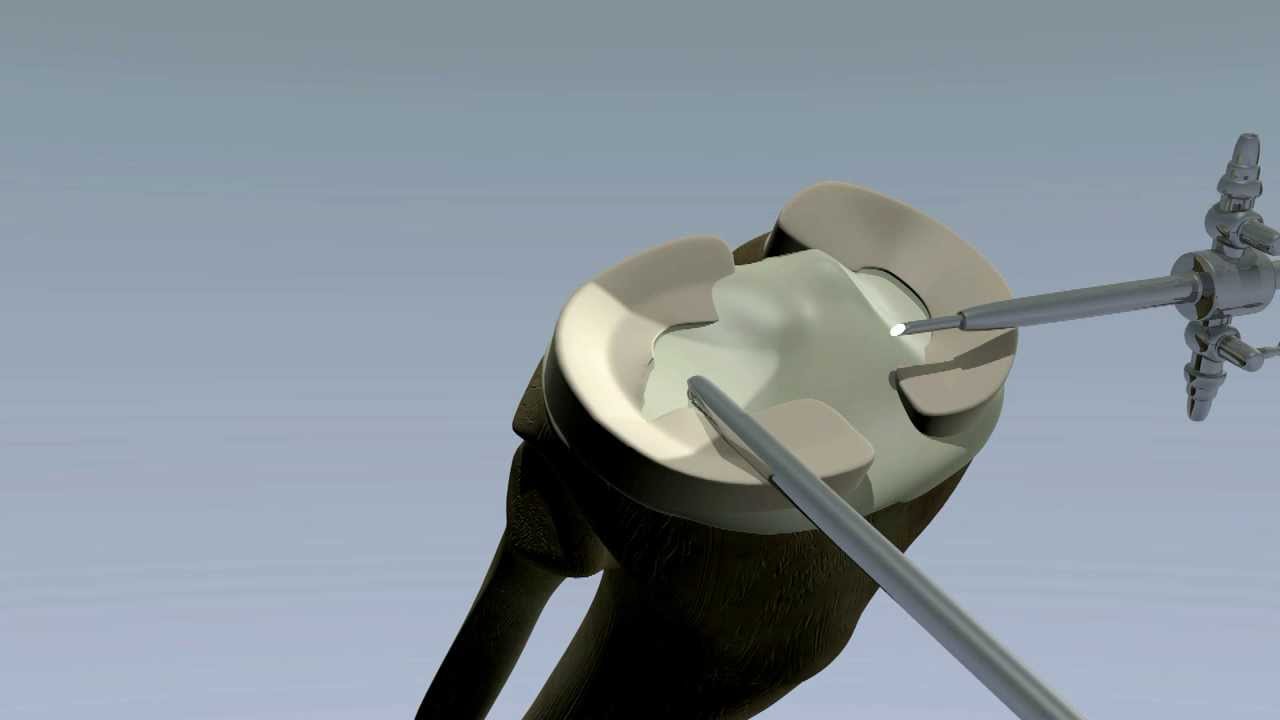 Wagner Isaias Piccoli-8