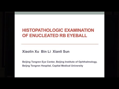 Retinoblastoma: Observations, Communication and Actions in Pathology of Retinoblastoma- Dr Xialin Xi