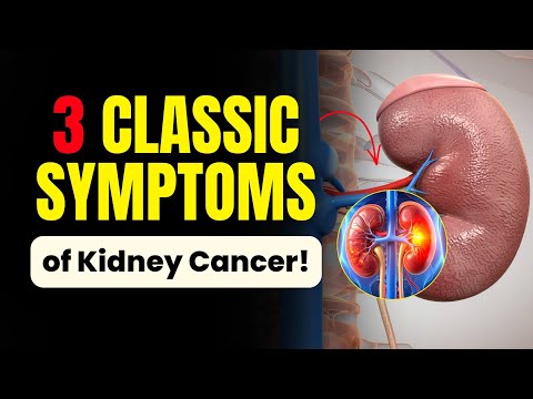 3 Classic Signs of Kidney Cancer You Should Never Ignore