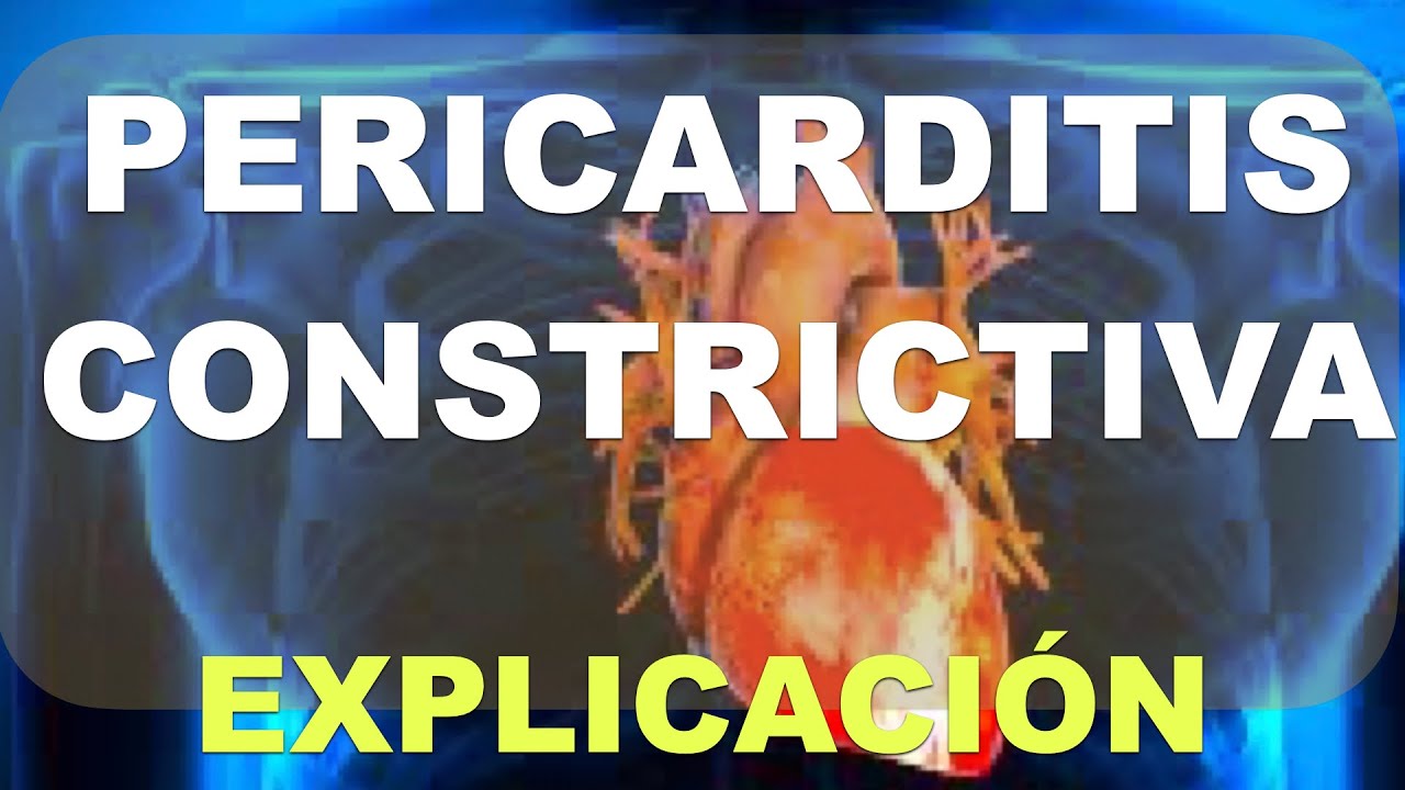 Pericarditis Constrictiva. Explicación