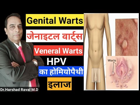 Hpv infection genital warts