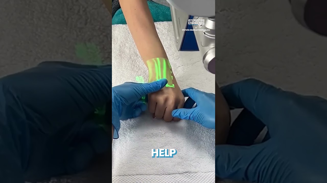 Vein Scanners - The Latest Innovation in Medicine