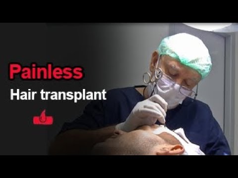 download lagu mp3 mp4 Painless Hair Transplant, download lagu Painless Hair Transplant gratis, unduh video klip Painless Hair Transplant