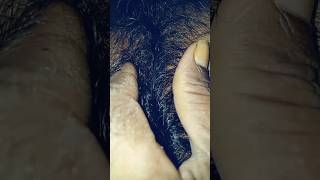 Download lagu Chest hair close up #shorts mp3