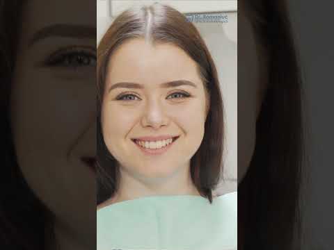 Ce probleme rezolva Dantura Fixa pe implanturi sau all on X?