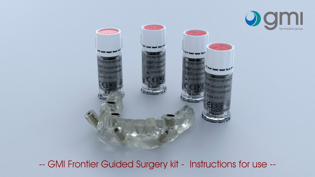 Frontier Guided Surgery Kit