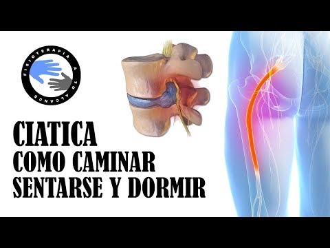 Ciática por hernia discal: cómo caminar, sentarse y dormir para aliviar el dolor