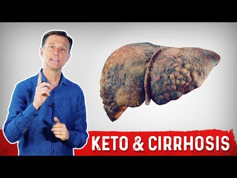 Can Keto (Ketogenic Diet) Help Cirrhosis of the Liver?