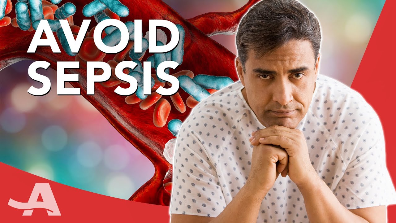 How to Prevent Sepsis