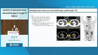 제25차 서울아산병원 호흡기내과 연수강좌 : Severe and intractable respiratory disease : Update of perioperative chemotherapy in stage III NSCLC 미리보기