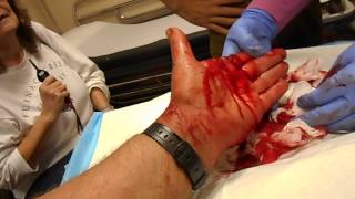 Worst Monitor Lizard Bite !