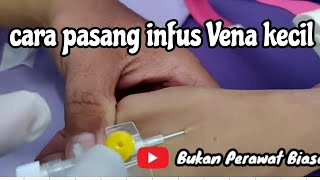 Download lagu cara pasang infus di Vena kecil mp3 Download lagu cara pasang infus di Vena kecil mp3