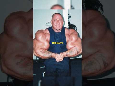 Greg Valentino, the man who’s arms exploded #synthol #bodybuilding