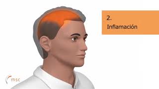 Después de la cirugía de cuello