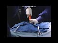 Inspector Gadget 1999 Deleted Scene The Longer Version Of The Surgery Scene