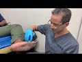 WANT TO LOSE A LEG FOLLOW THIS RECIPE DIABETES IS A REAL CANCER