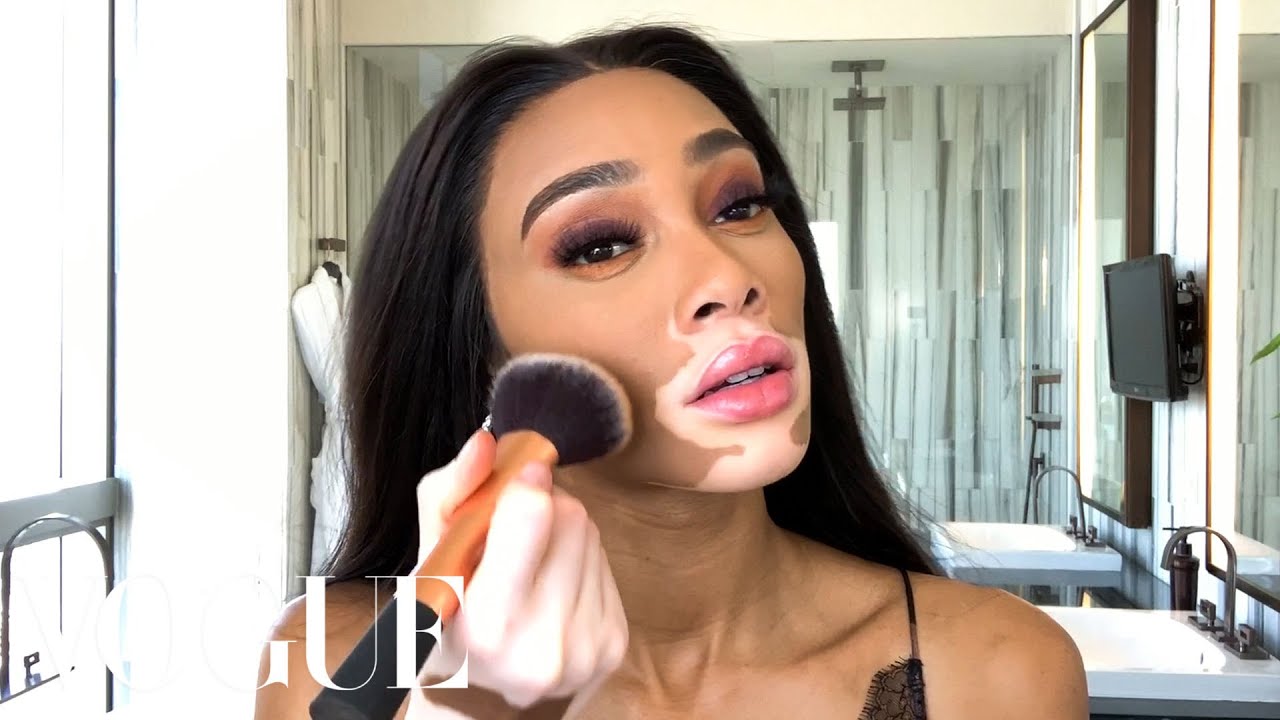 Winnie Harlow