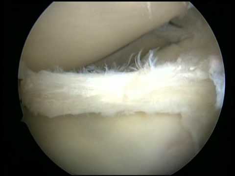 Temperatura di osteocondrosi Dolore PMS dalla schiena e vita
