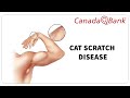 Cat Scratch Disease Symptoms Diagnosis Treatment Bartonella Henselae CanadaQBank