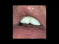 Playboi Carti WHAT U NEED Ft The Weeknd Audio