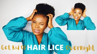 Home Remedies To Get Rid Of Hair Lice Overnight || How to get rid of hair lice overnight