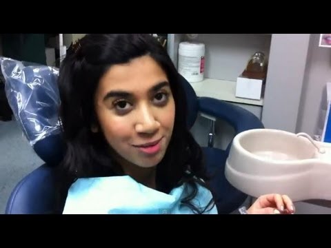Dr. Ben Fong First 3 Invisalign Trays Before After - Lara