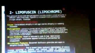 2_Dr.Faisal  - Apoptosis and Necrosis part 8