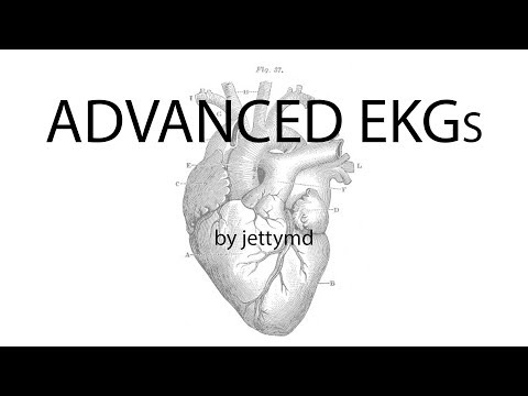 ADVANCED EKGs