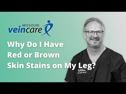 Why Do I Have Red or Brown Skin Stains on My Leg?