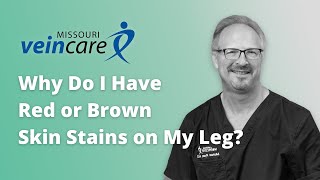 Why Do I Have Red or Brown Skin Stains on My Leg?