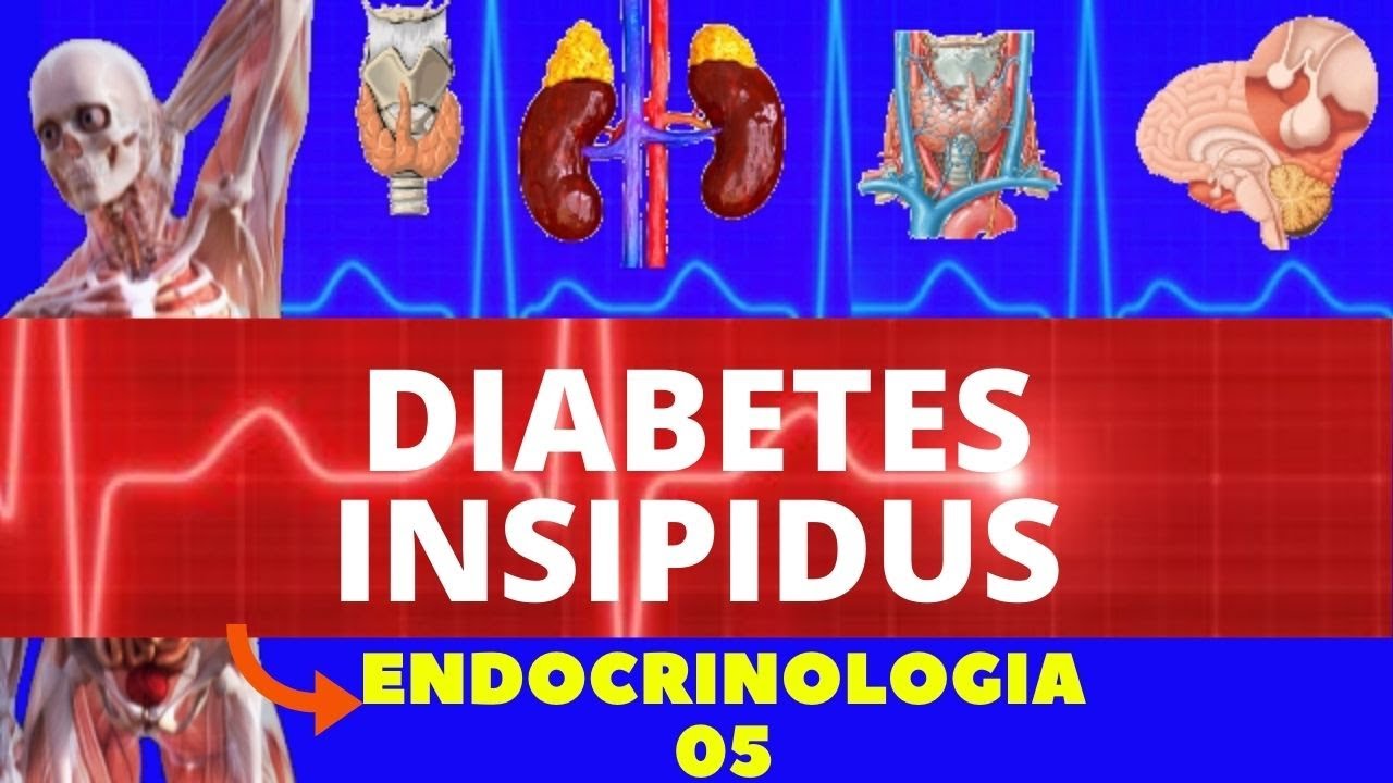 DIABETES INSIPIDUS (CAUSA, FISIOPATOLOGIA, DIAGNÓSTICO E TRATAMENTO) - ENDOCRINOLOGIA
