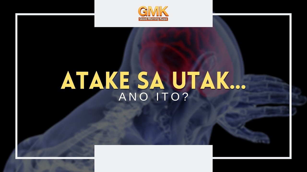 Putar video Atake sa utak... ano ito (PART 1) | Usapang Pangkalusugan sekarang Atake sa utak... ano ito (PART 1) | Usapang Pangkalusugan