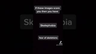 Skelephobia fear of skeletons