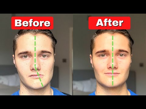 How to Fix Asymmetrical Jaw & Face (TODAY!)