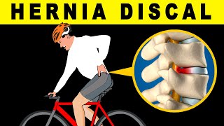 😧¿ES BUENO PEDALEAR CON HERNIA DISCAL (PUEDE QUE TENGAS UNA Y NO LO SEPAS)🚲 SALUD CICLISTA