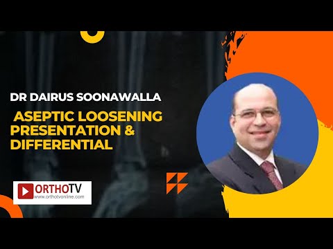 Dr Dairus Soonawalla - Aseptic Loosening Presentation & Differential