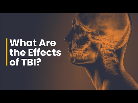 Why Cocooning Makes Concussion Worse Substack Shorts