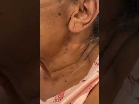 video gnyE2SO6g58