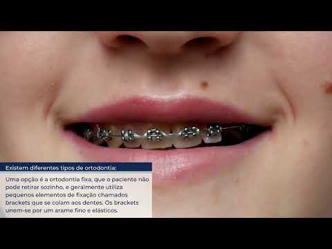 DentTV - A ortodontia